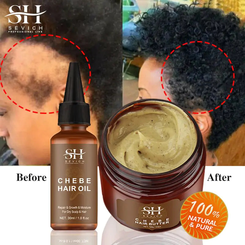 Alopecia Natural Regrowth Treatment Oil