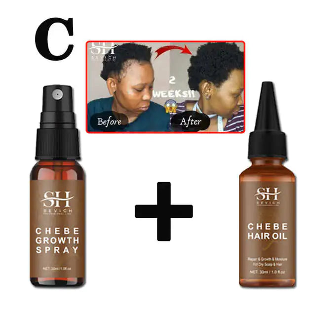 Alopecia Natural Regrowth Treatment Oil