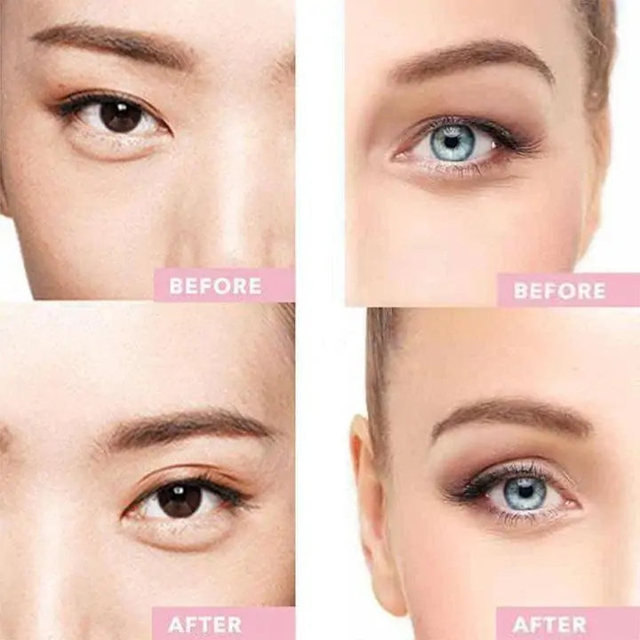 Eye Instant Lift