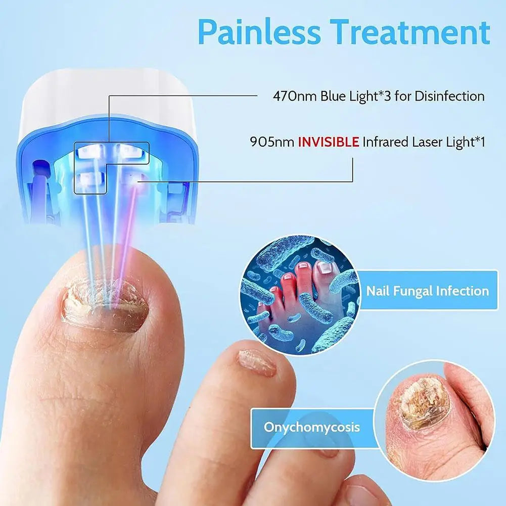 Nail Fungus Laser Treatment Device