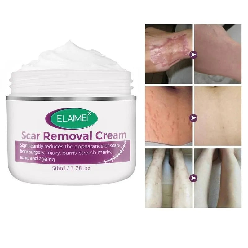 Scar Removal Cream