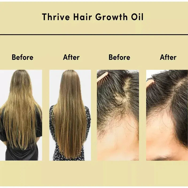 Thrive Hair Growth Essential Oil